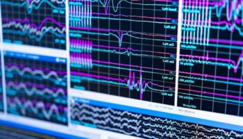 Gabapentinoid medical detox