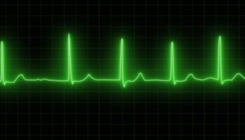Ibogaine heart study