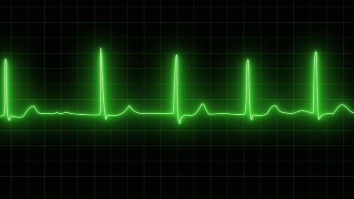 Ibogaine heart study