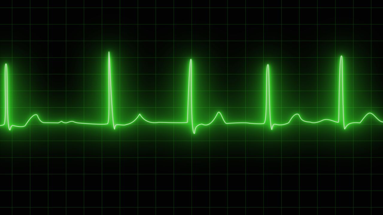 Ibogaine heart study